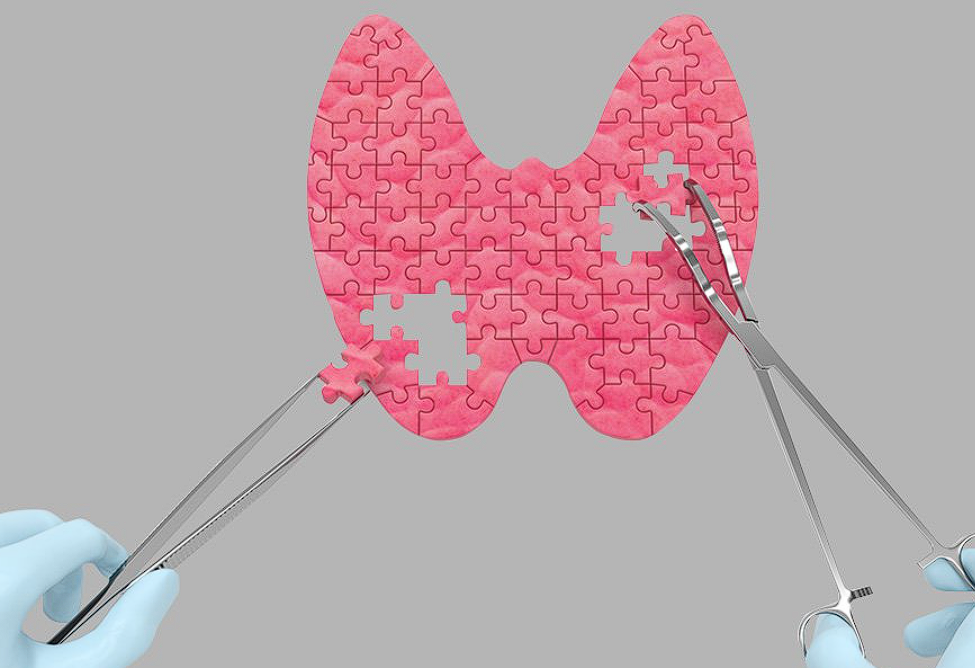 बच्चों और किशोरों में Hypothyroidism के लक्षण